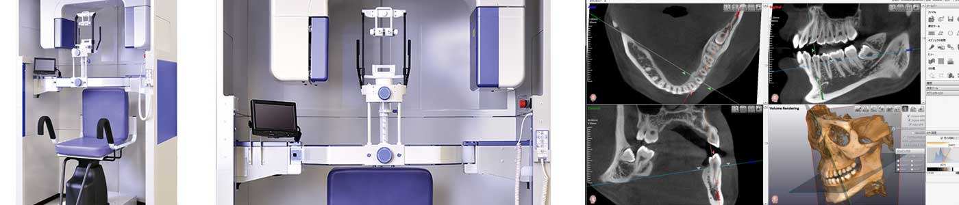 歯科用CTの導入